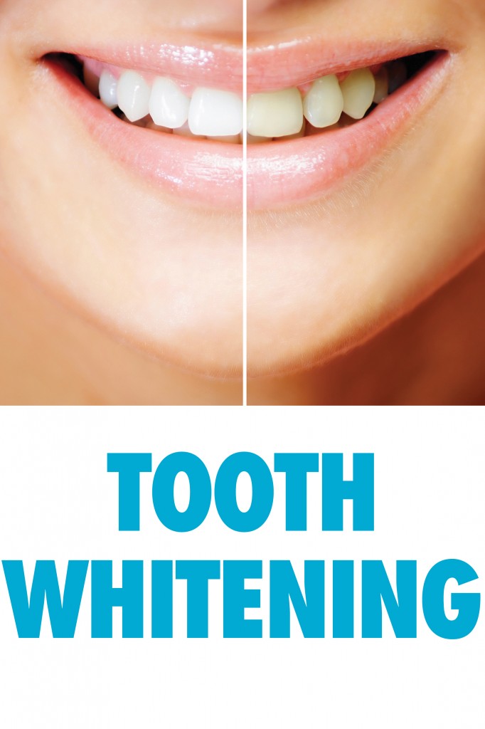 Tooth Whitening and smile